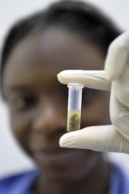 Namibia, Otjiwarongo, Cheetah Conservation Fund, research and education centre, extraction by Harmony of cheetah's feces in a micro tube in order to extract DNA