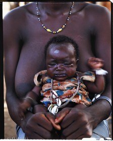 Burkina Faso, province de Poni, pays des Lobi, Loropéni, femme lobi tenant son enfant malade